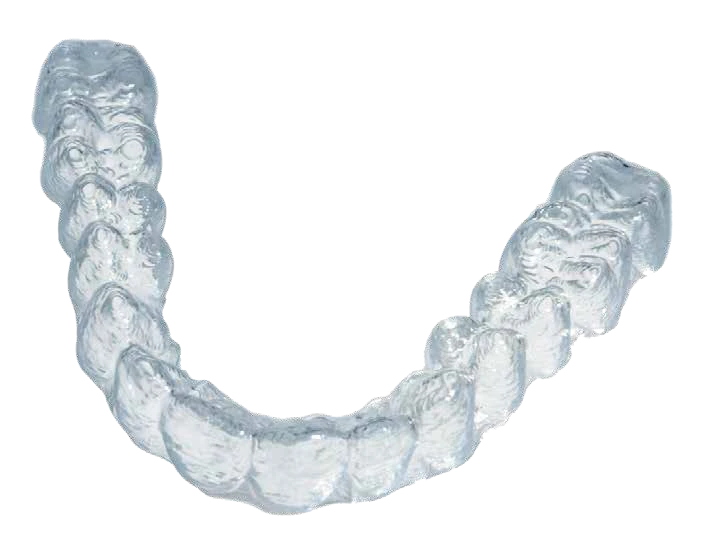 Une gouttière transparente Smile Aligner